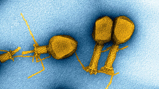Electron microscopy of T4 bacteriophages.