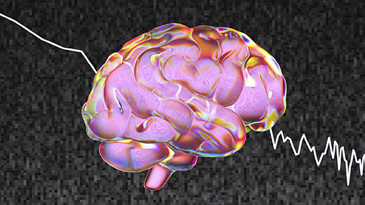 An illustration of a human brain against “pink noise” static.