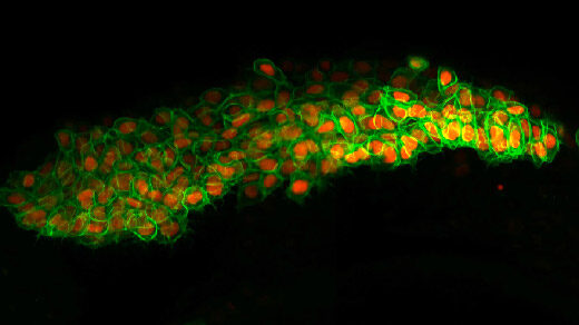 Video of fluorescent neural crest cells migrating through zebra fish tissues.