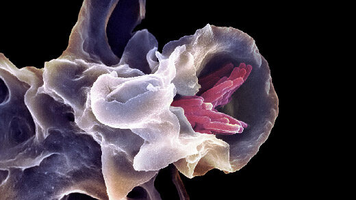Micrograph of a macrophage phagocytosing bacteria.