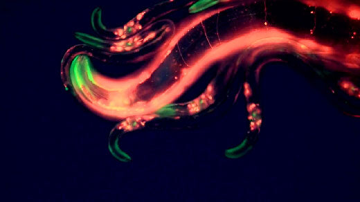 Video microscopy of a large C. elegans roundworm flanked by several much smaller ones.