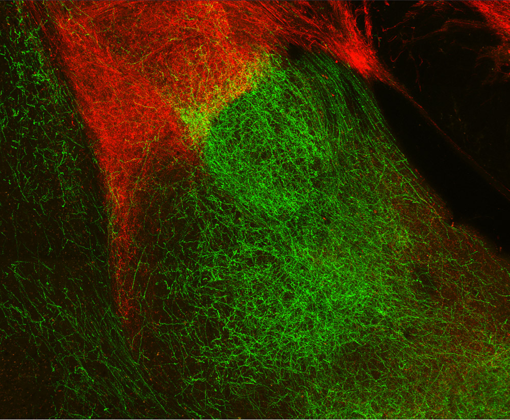 : A photo of adjacent brain areas, one stained red, one stained green